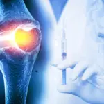 Breakthrough Injectable Hydrogel Promises Long-Lasting Relief and Disease Modification for Osteoarthritis Sufferers
