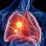 Breaking the Shield: How a Novel Mitochondrial Target and a Modified Antibiotic Offer New Hope in the Battle Against Mesothelioma