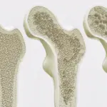 Brewed Balance: How Daily Coffee and Tea Habits Shape Bone Health in Older Women