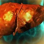 Hidden Scars: How a Common Industrial Chemical is Rewriting the Map of Liver Disease