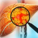 Rethinking "Sugar-Free": New Research Reveals Common Sweetener Sorbitol May Mimic Fructose and Burden the Liver