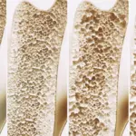 Unlocking the Skeletal Matrix: Leipzig Researchers Identify GPR133 as a Breakthrough Target for Osteoporosis and Muscle Decline