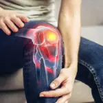 Beyond the Joint: How a Simple Daily Fiber Supplement Is Redefining Knee Osteoarthritis Treatment