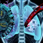 Breakthrough Nanoparticle Therapy Developed at Oregon State University Targets Both Lung Tumors and Muscle-Wasting Cachexia