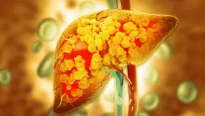 Guarding the Vital Organ: Breakthrough Discovery Reveals Enzyme’s Protective Role Against Advanced Liver Disease