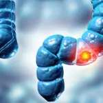 The Silent Surge: Why Advanced Colorectal Cancer Is Striking the Young—and Why Doctors Are Missing It